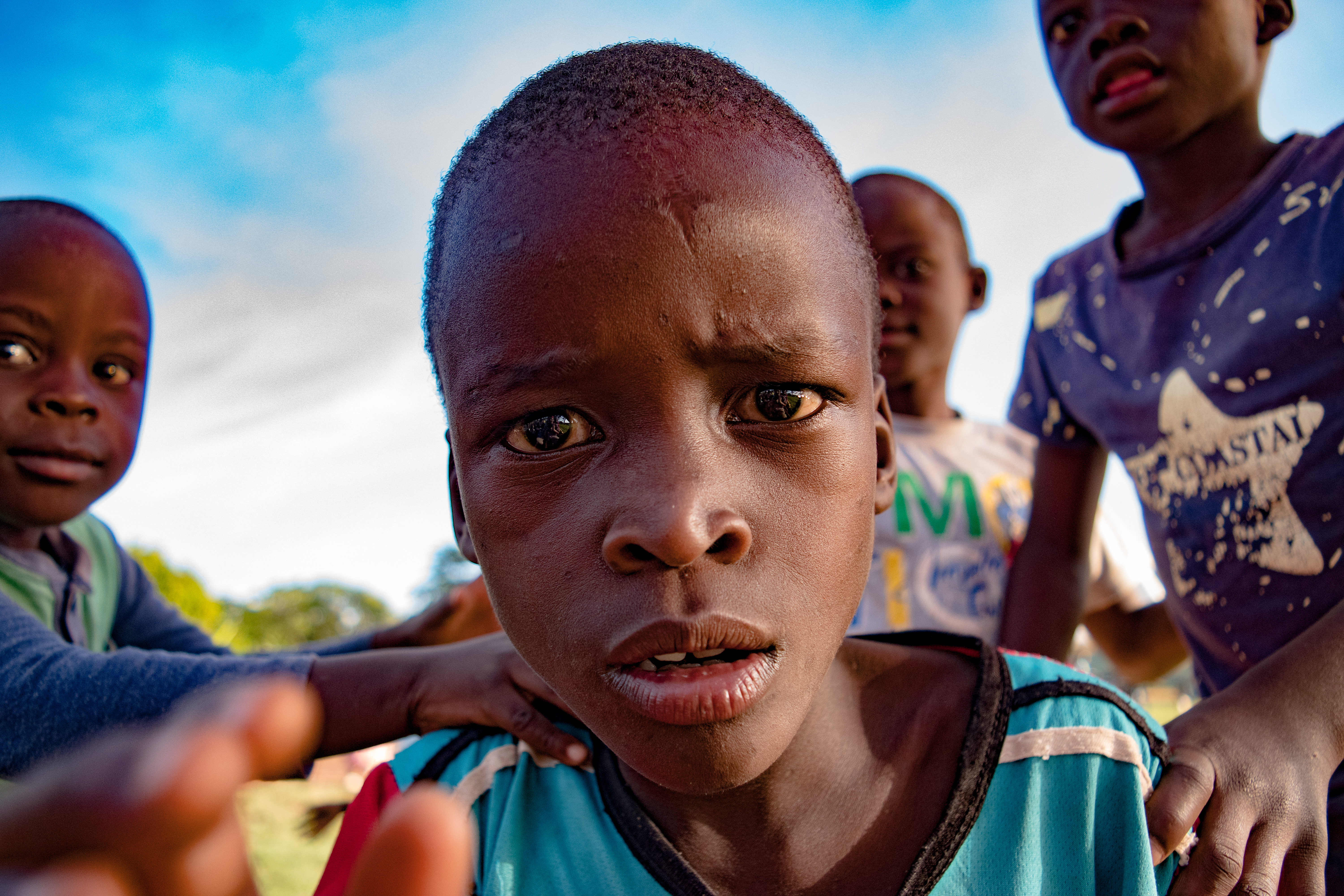 Close-up portrait of a young boy surrounded by friends outdoors under a bright sky